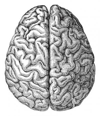 cerebro de demencia