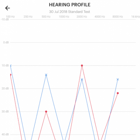 ¿Pueden los auriculares inalámbricos Audeara A-01 ayudar con la pérdida auditiva de la vejez? (Revisión y sorteo) perfil de audición audeara auriculares 503x500
